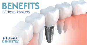 Dental Implant